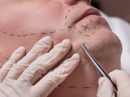 Beard Transplant Beard Transplant in Istanbul