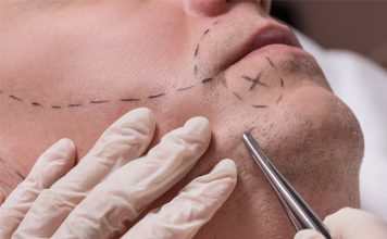 Beard Transplant Beard Transplant in Istanbul