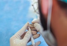 DHI Hair Transplant DHI Hair Transplant in Istanbul