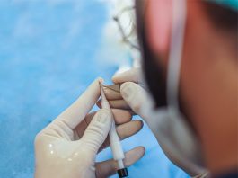 DHI Hair Transplant DHI Hair Transplant in Istanbul