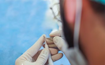 DHI Hair Transplant DHI Hair Transplant in Istanbul