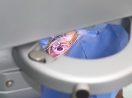 Excimer Laser Excimer Laser in Istanbul