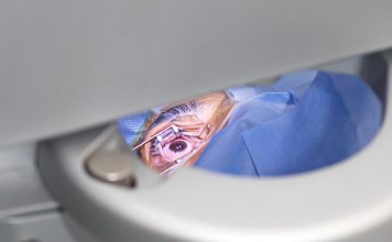 Excimer Laser Excimer Laser in Istanbul