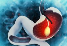 Gastric Balloon Gastric Balloon in Istanbul