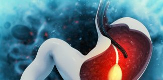 Gastric Balloon Gastric Balloon in Istanbul