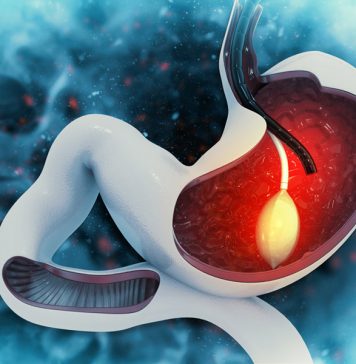 Gastric Balloon Gastric Balloon in Istanbul