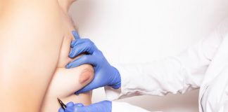 Gynecomastia Surgery Gynecomastia in Istanbul