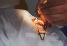 LASIK Eye Surgery LASIK Eye Surgery in Istanbul