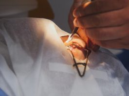 LASIK Eye Surgery LASIK Eye Surgery in Istanbul