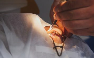 LASIK Eye Surgery LASIK Eye Surgery in Istanbul