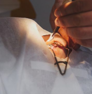 LASIK Eye Surgery LASIK Eye Surgery in Istanbul