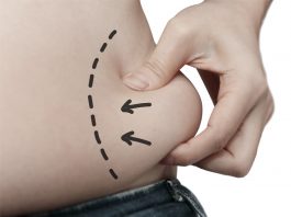 Liposuction Liposuction in Istanbul