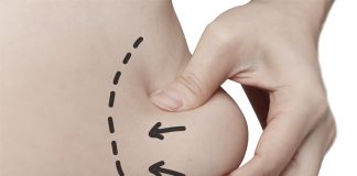 Liposuction Liposuction in Istanbul