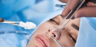 Nose Job (Rhinoplasty) Nose Job (Rhinoplasty) in Istanbul