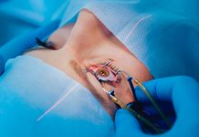 PRK Laser Eye Surgery PRK Laser Eye Surgery in Istanbul