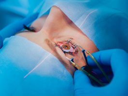 PRK Laser Eye Surgery PRK Laser Eye Surgery in Istanbul