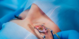 PRK Laser Eye Surgery PRK Laser Eye Surgery in Istanbul