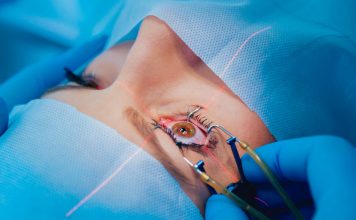 PRK Laser Eye Surgery PRK Laser Eye Surgery in Istanbul