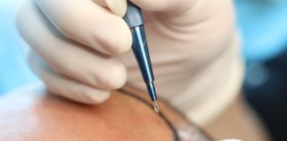 Sapphire FUE Hair Transplant Sapphire FUE Hair Transplant in Istanbul