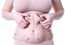 Vaser Liposuction Vaser Liposuction in Istanbul