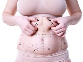 Vaser Liposuction Vaser Liposuction in Istanbul