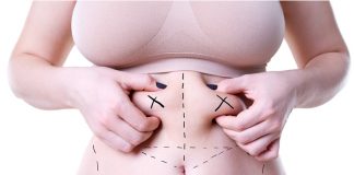 Vaser Liposuction Vaser Liposuction in Istanbul
